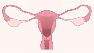 Low Cost Evaluations and HSGs at Pathways Fertility