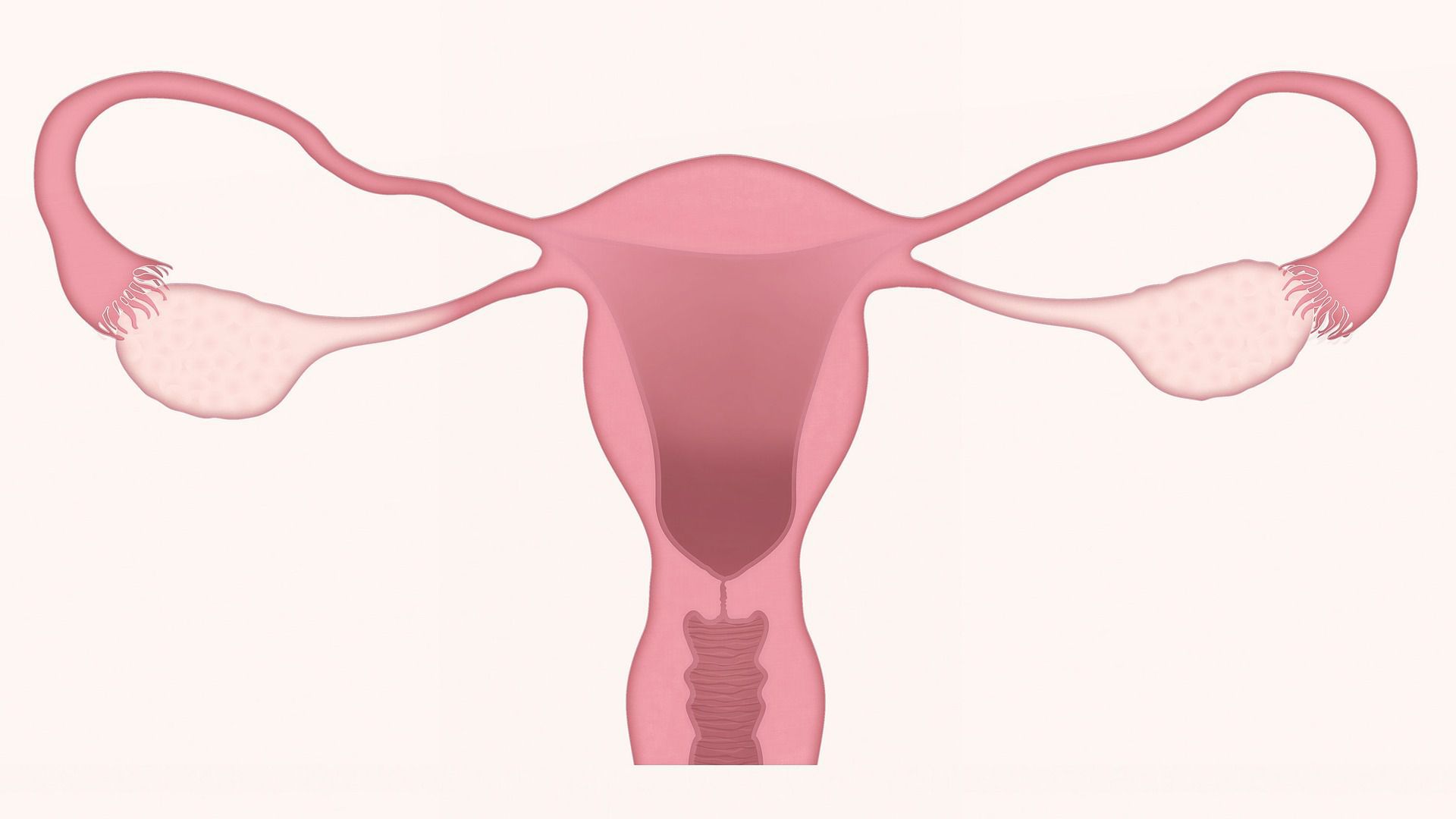 Low Cost Evaluations and HSGs at Pathways Fertility